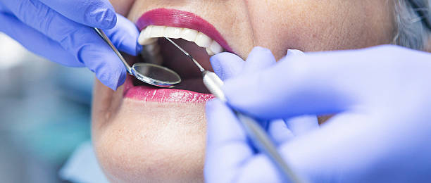 Best Emergency Tooth Extraction in Und City, MO