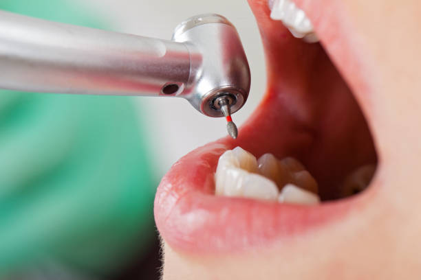 Best Weekend Emergency Dentist in Und City, MO